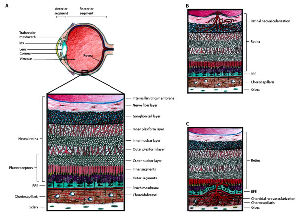 The potential of nanomedicine therapies to treat neovascular disease in the retina.