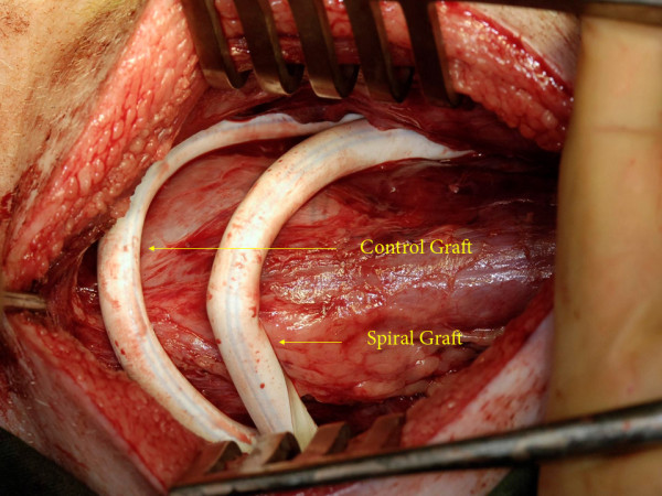 An animal paired crossover ePTFE arteriovenous graft model.