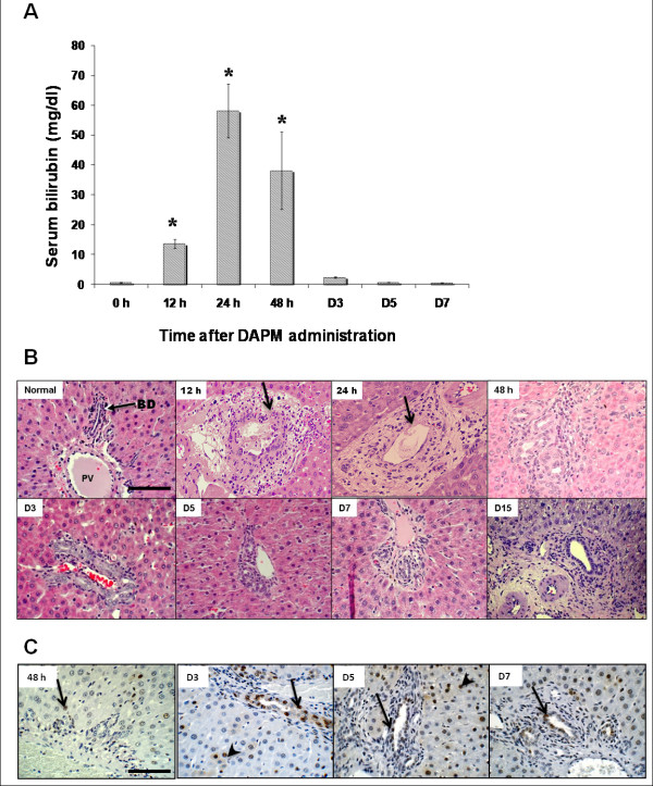 Expression of hepatocytic- and biliary-specific transcription factors in regenerating bile ducts during hepatocyte-to-biliary epithelial cell transdifferentiation.