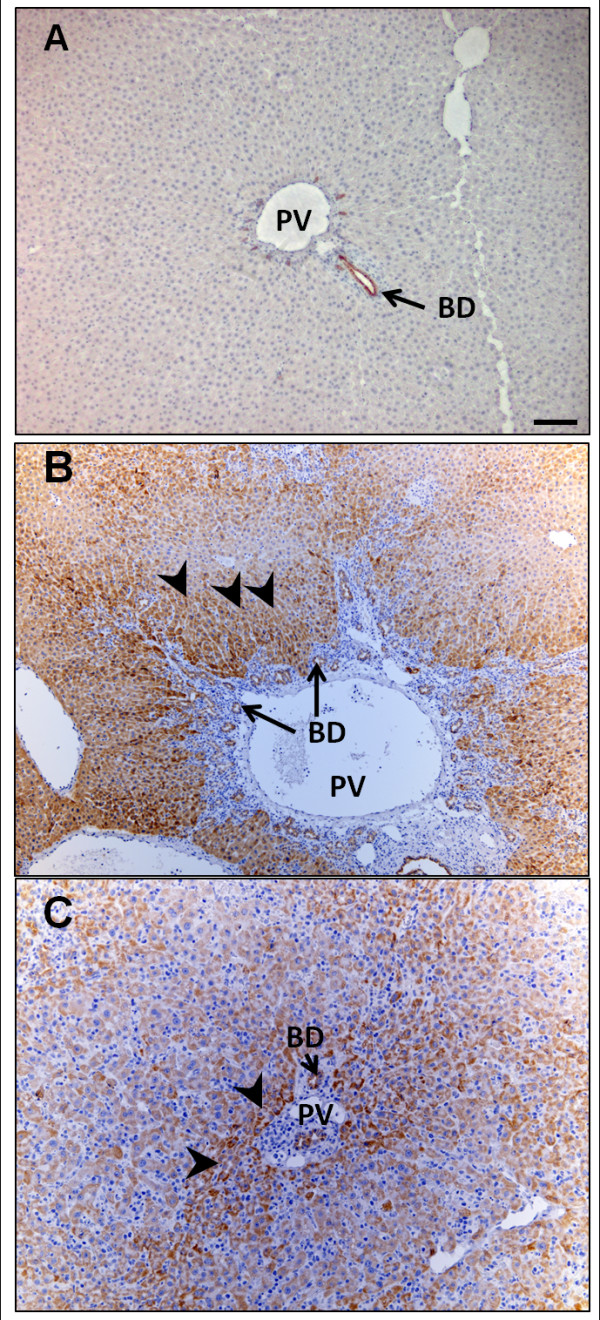 Expression of hepatocytic- and biliary-specific transcription factors in regenerating bile ducts during hepatocyte-to-biliary epithelial cell transdifferentiation.