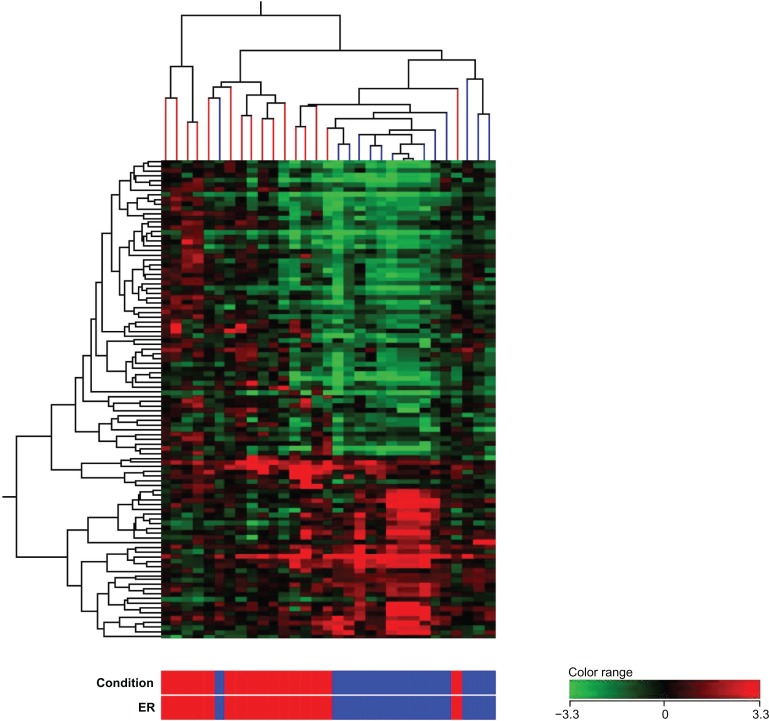 Identification of gene expression signature in estrogen receptor positive breast carcinoma.