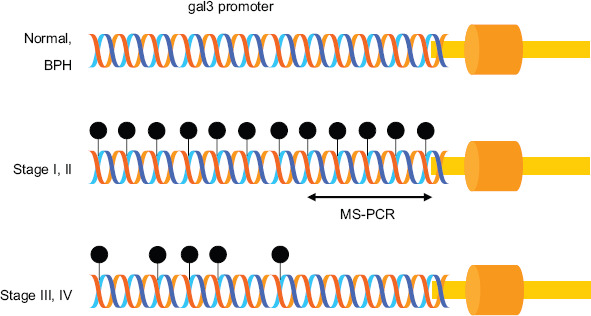 Promoter methylation in prostate cancer and its application for the early detection of prostate cancer using serum and urine samples.