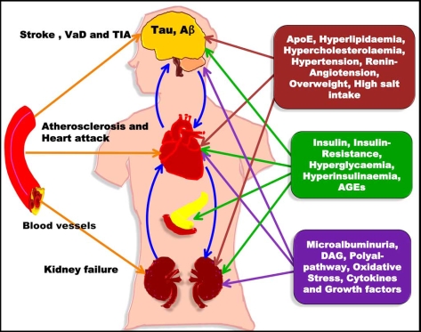 Cardiovascular dementia - a different perspective.