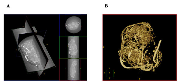 Micro computed tomography for vascular exploration.