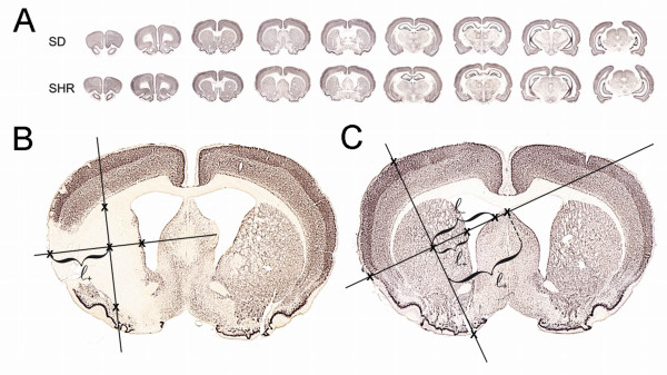 Neuronal precursor cell proliferation in the hippocampus after transient cerebral ischemia: a comparative study of two rat strains using stereological tools.