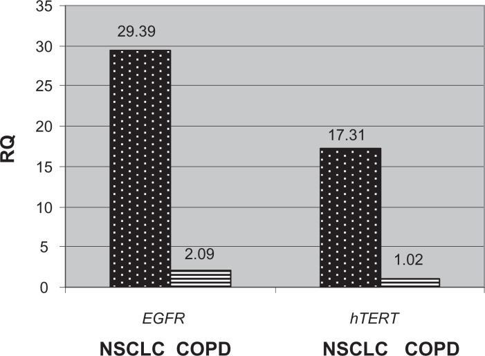 EGFR and hTERT Expression as a Diagnostic Approach for Non-small Cell Lung Cancer in High Risk Groups.