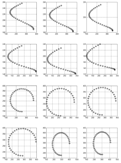 Monoplane 3D reconstruction of mapping ablation catheters: a feasibility study.