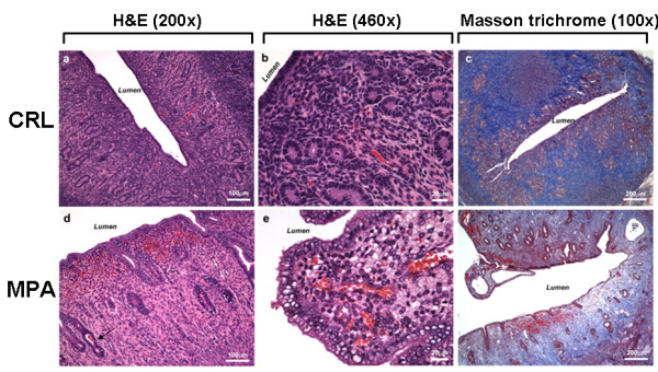 Long-term progestin contraceptives (LTPOC) induce aberrant angiogenesis, oxidative stress and apoptosis in the guinea pig uterus: A model for abnormal uterine bleeding in humans.