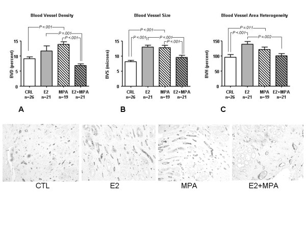 Long-term progestin contraceptives (LTPOC) induce aberrant angiogenesis, oxidative stress and apoptosis in the guinea pig uterus: A model for abnormal uterine bleeding in humans.