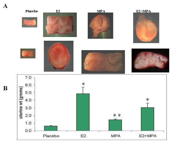 Long-term progestin contraceptives (LTPOC) induce aberrant angiogenesis, oxidative stress and apoptosis in the guinea pig uterus: A model for abnormal uterine bleeding in humans.