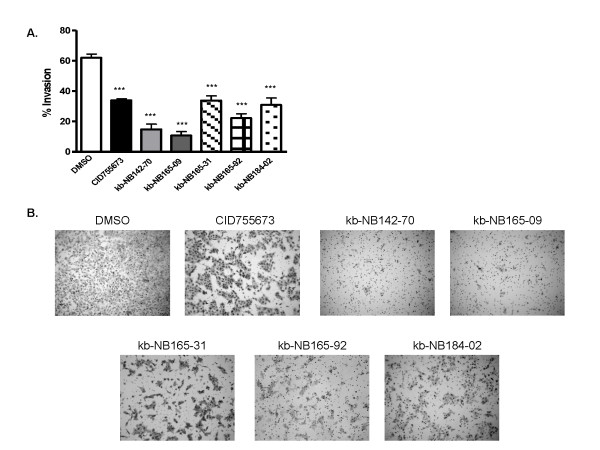 Novel protein kinase D inhibitors cause potent arrest in prostate cancer cell growth and motility.