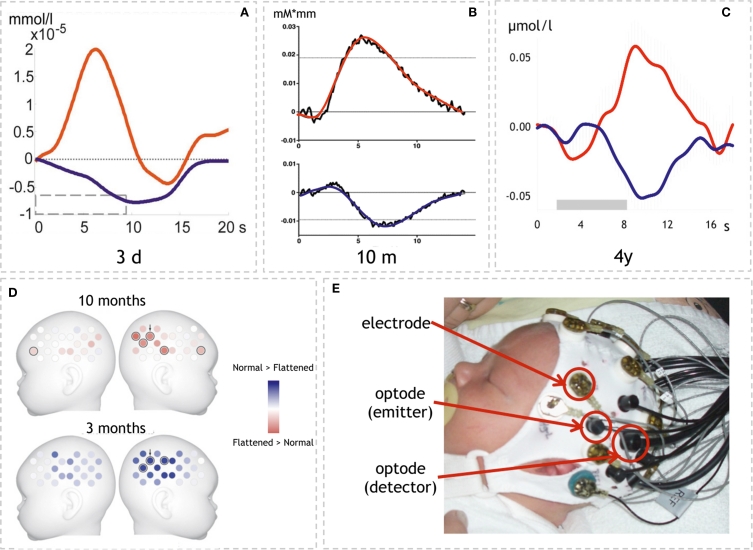 From acoustic segmentation to language processing: evidence from optical imaging.