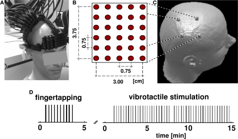 High-resolution optical functional mapping of the human somatosensory cortex.