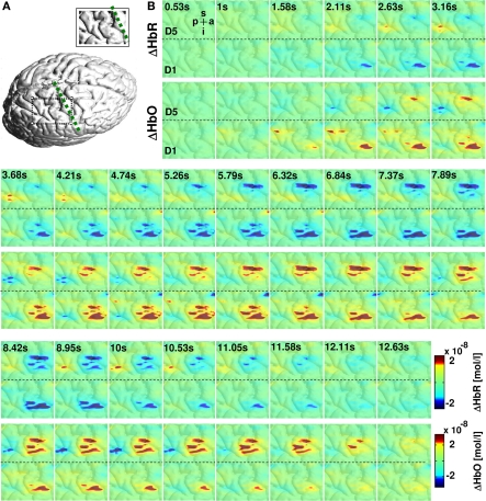 High-resolution optical functional mapping of the human somatosensory cortex.