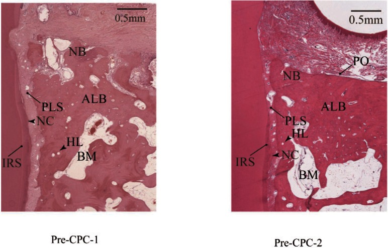 In Vivo Characteristics of Premixed Calcium Phosphate Cements When Implanted in Subcutaneous Tissues and Periodontal Bone Defects.