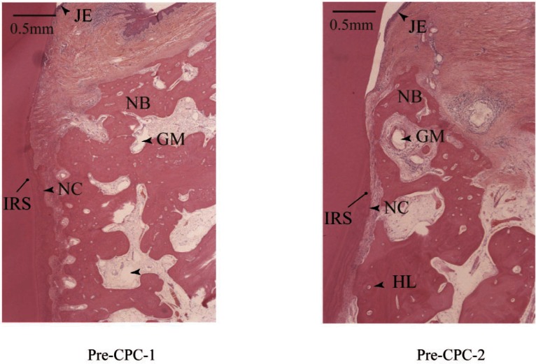 In Vivo Characteristics of Premixed Calcium Phosphate Cements When Implanted in Subcutaneous Tissues and Periodontal Bone Defects.