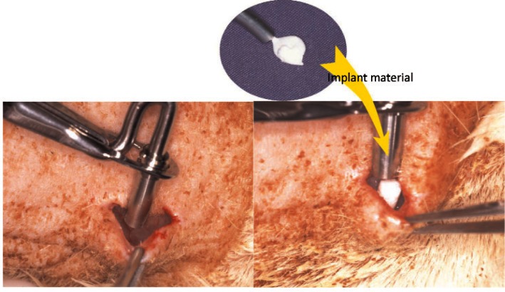 In Vitro and in Vivo Characteristics of Fluorapatite-Forming Calcium Phosphate Cements.