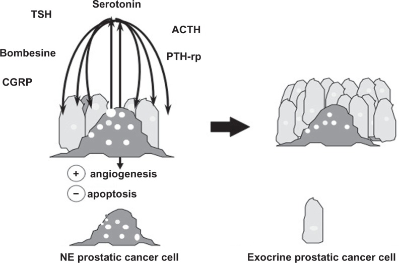 Prognostic role of neuroendocrine differentiation in prostate cancer, putting together the pieces of the puzzle.