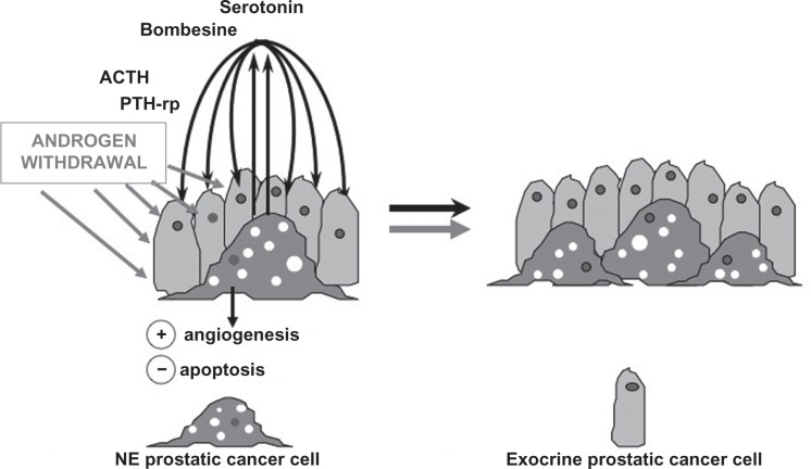 Prognostic role of neuroendocrine differentiation in prostate cancer, putting together the pieces of the puzzle.