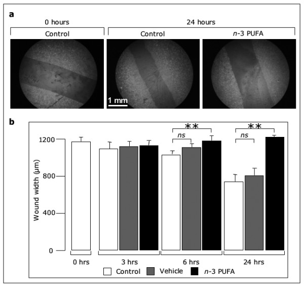 Eicosapentaenoic acid inhibits endothelial cell migration in vitro.