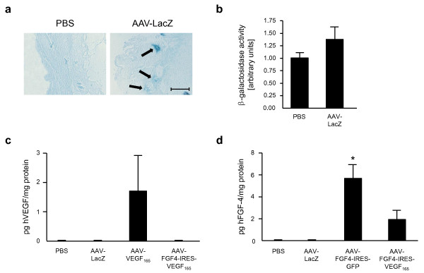 Combined vascular endothelial growth factor-A and fibroblast growth factor 4 gene transfer improves wound healing in diabetic mice.