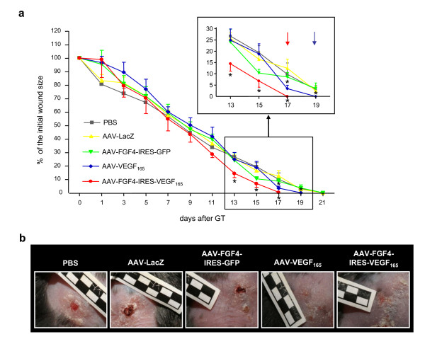 Combined vascular endothelial growth factor-A and fibroblast growth factor 4 gene transfer improves wound healing in diabetic mice.