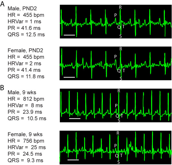 Development of electrocardiogram intervals during growth of FVB/N neonate mice.