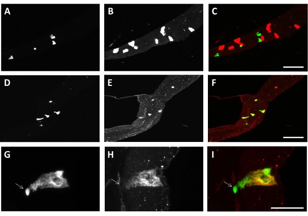Peristalsis in the junction region of the Drosophila larval midgut is modulated by DH31 expressing enteroendocrine cells.