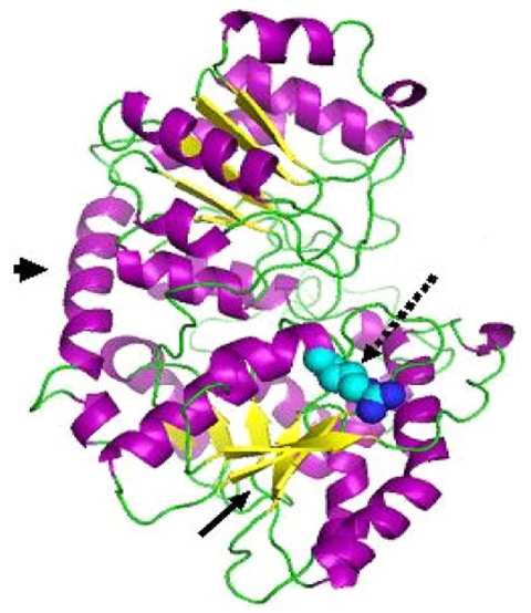 A case of concomitant Gilbert's syndrome and hereditary spherocytosis.