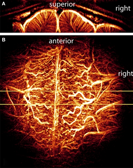 Recent Advances in High-Resolution MR Application and Its Implications for Neurovascular Coupling Research.