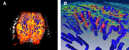 Recent Advances in High-Resolution MR Application and Its Implications for Neurovascular Coupling Research.