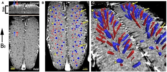 Recent Advances in High-Resolution MR Application and Its Implications for Neurovascular Coupling Research.