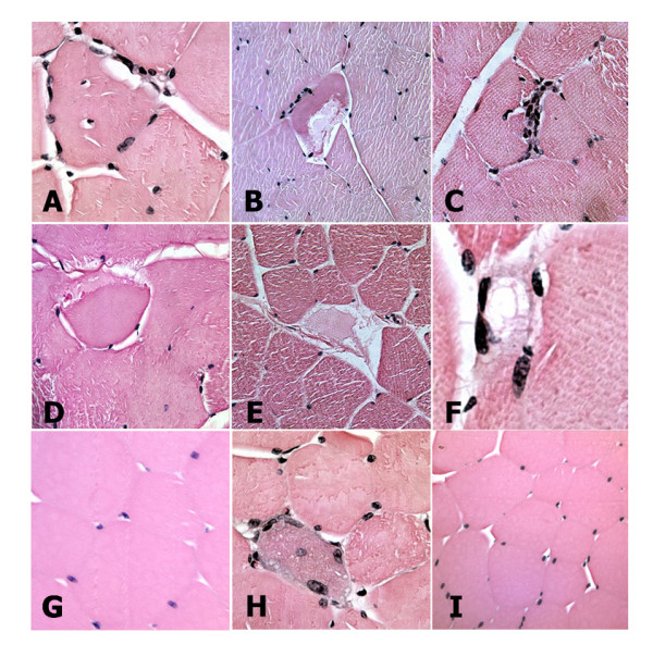 Increased expression and local accumulation of the prion protein, Alzheimer Aβ peptides, superoxide dismutase 1, and nitric oxide synthases 1 & 2 in muscle in a rabbit model of diabetes.