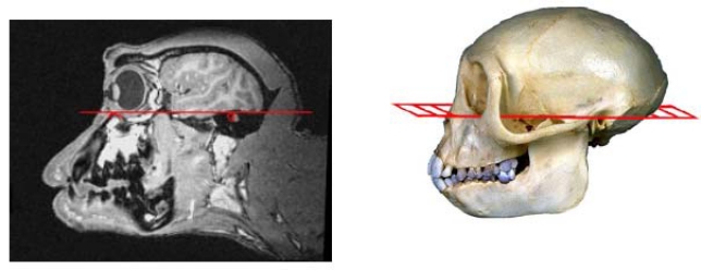 A frameless stereotaxic MRI technique for macaque neuroscience studies.