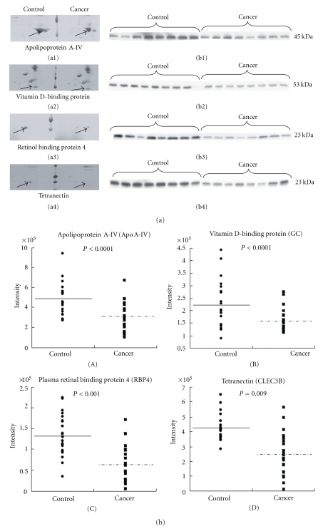 The application of a three-step proteome analysis for identification of new biomarkers of pancreatic cancer.