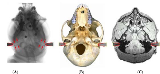 A frameless stereotaxic MRI technique for macaque neuroscience studies.