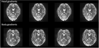 High-field FMRI for human applications: an overview of spatial resolution and signal specificity.