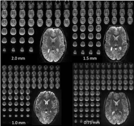 High-field FMRI for human applications: an overview of spatial resolution and signal specificity.