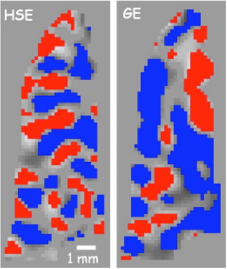 High-field FMRI for human applications: an overview of spatial resolution and signal specificity.