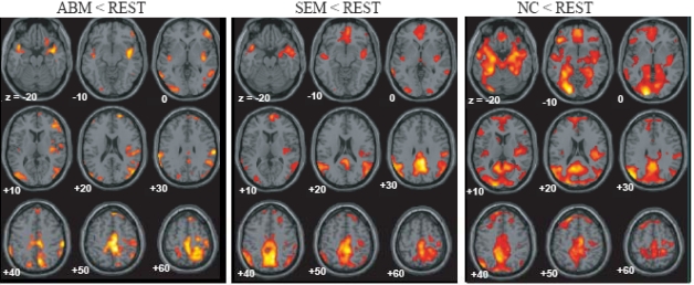 Brain activation during autobiographical memory retrieval with special reference to default mode network.