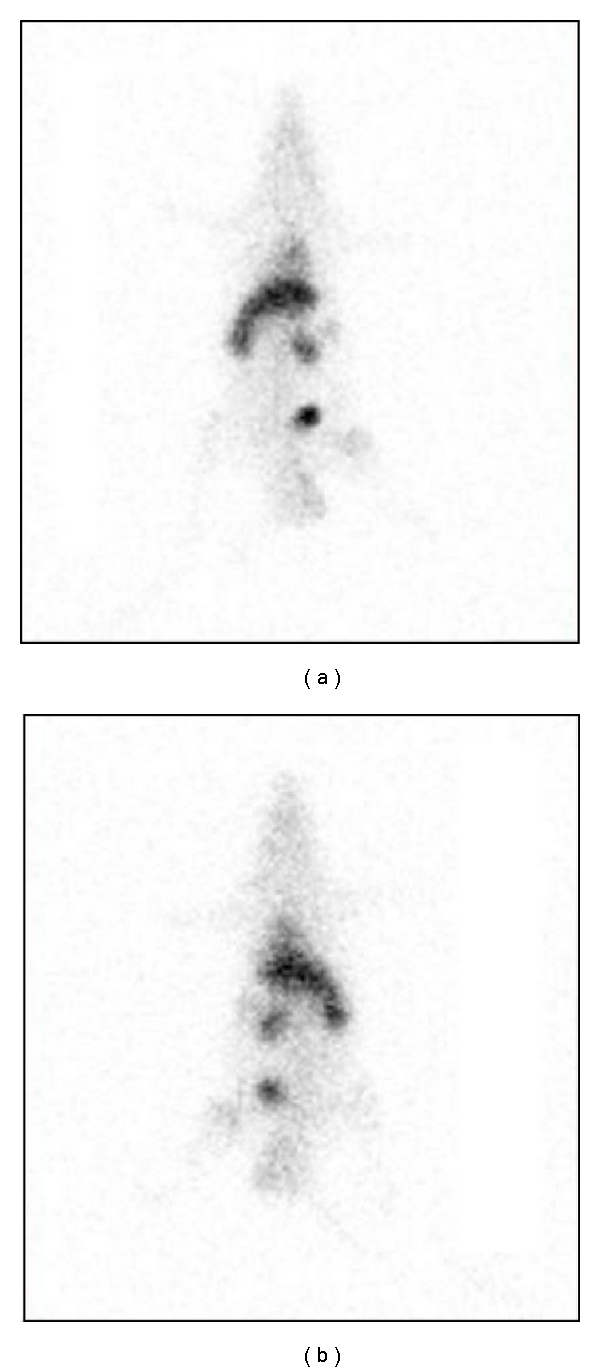 Radiolabeling of cramoll 1,4: evaluation of the biodistribution.