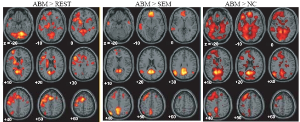 Brain activation during autobiographical memory retrieval with special reference to default mode network.