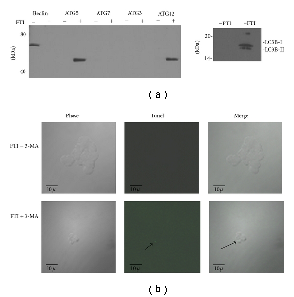 Breast cancer stem cells survive periods of farnesyl-transferase inhibitor-induced dormancy by undergoing autophagy.