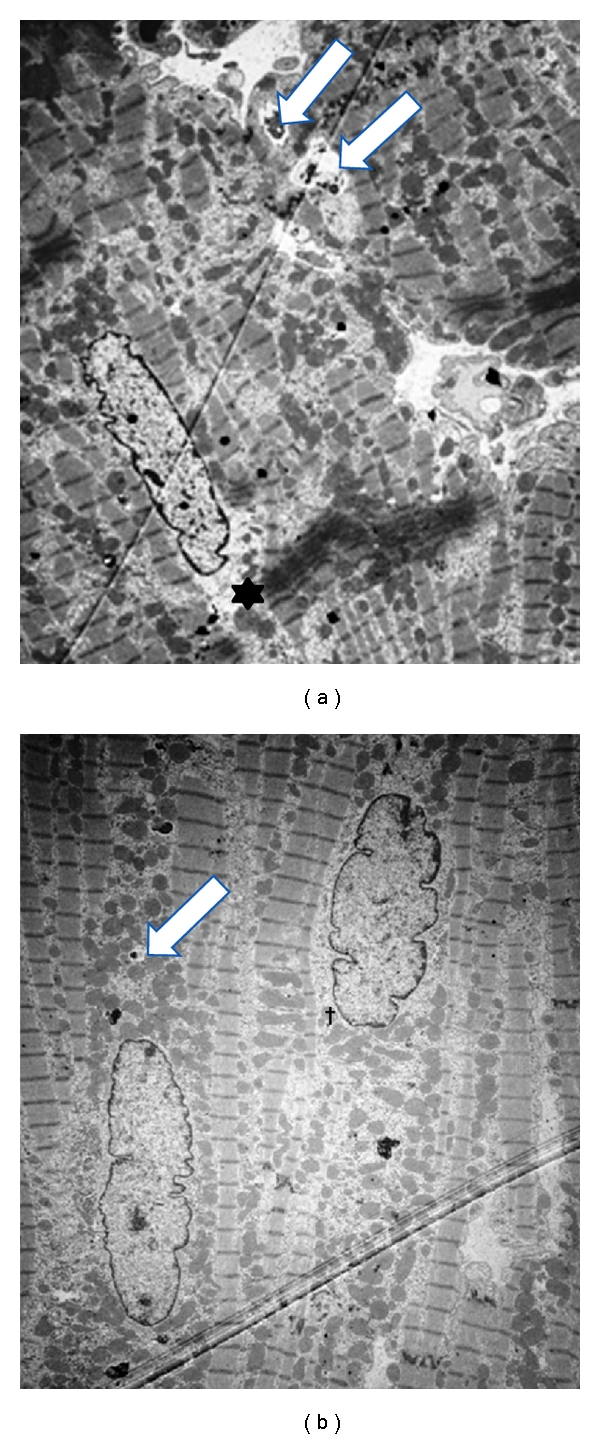 Modification of a volume-overload heart failure model to track myocardial remodeling and device-related reverse remodeling.