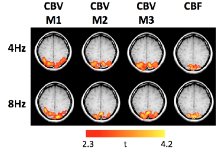 Cerebral Blood Volume Measurements - Gd_DTPA vs. VASO - and Their Relationship with Cerebral Blood Flow in Activated Human Visual Cortex.