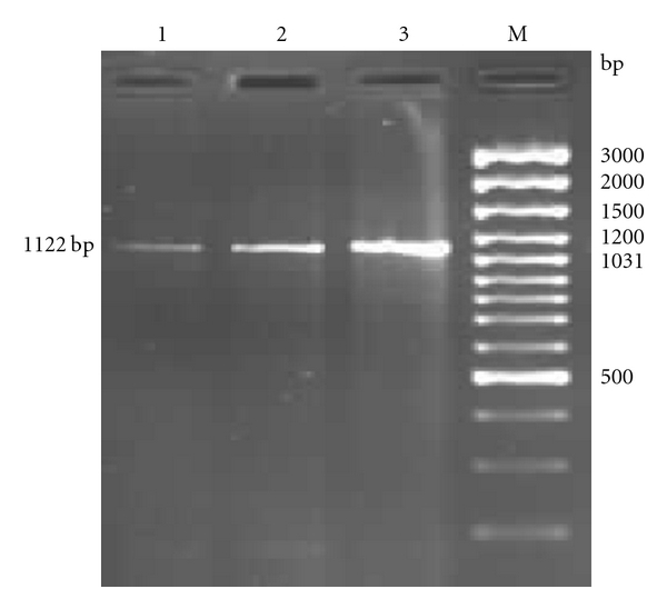 Molecular Characterization and SNP Detection of CD14 Gene of Crossbred Cattle.