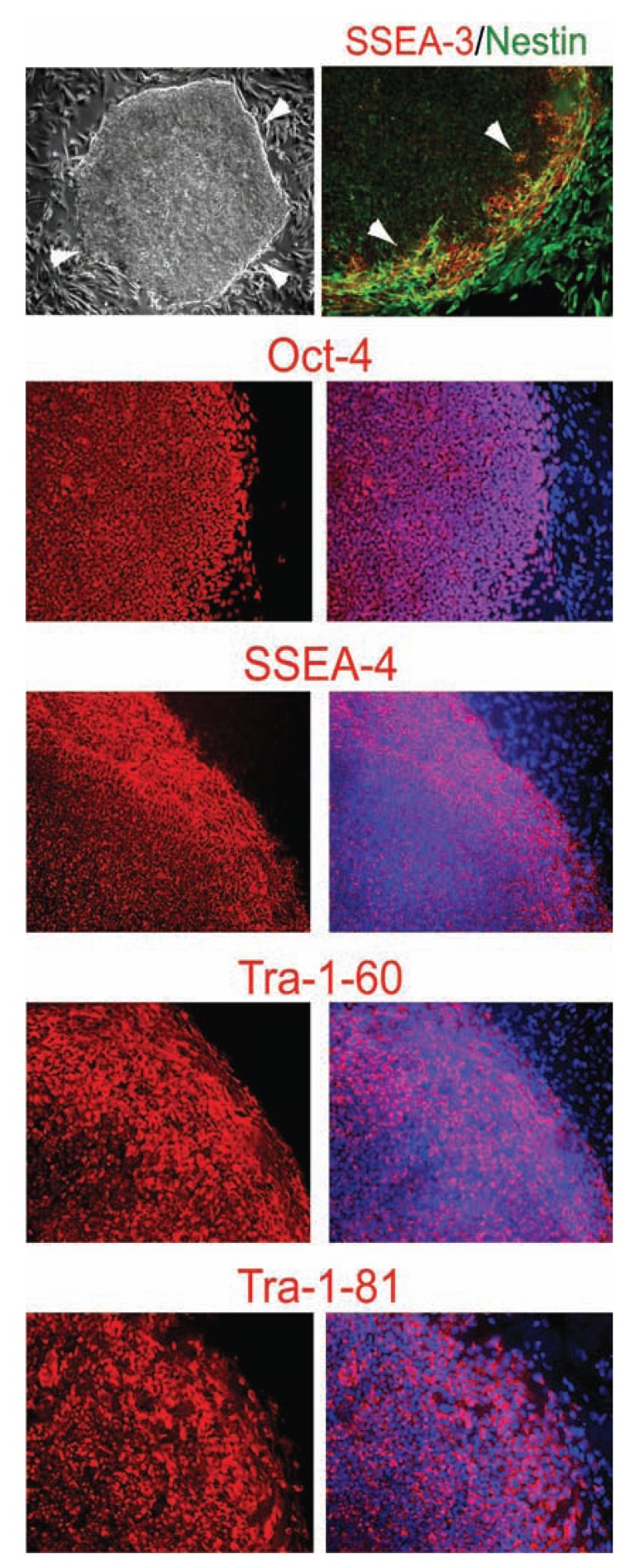 Patents on Technologies of Human Tissue and Organ Regeneration from Pluripotent Human Embryonic Stem Cells.