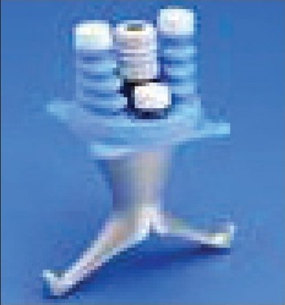Single-port access laparoscopic hysterectomy: a new dimension of minimally invasive surgery.