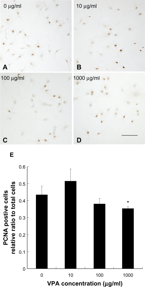 The effect of valproic Acid on mesenchymal pluripotent cell proliferation and differentiation in extracellular matrices.