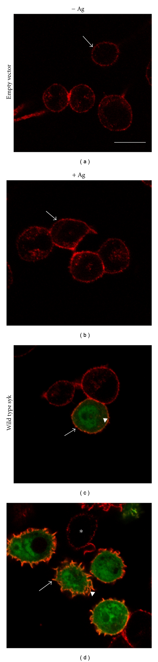Regulation and function of syk tyrosine kinase in mast cell signaling and beyond.